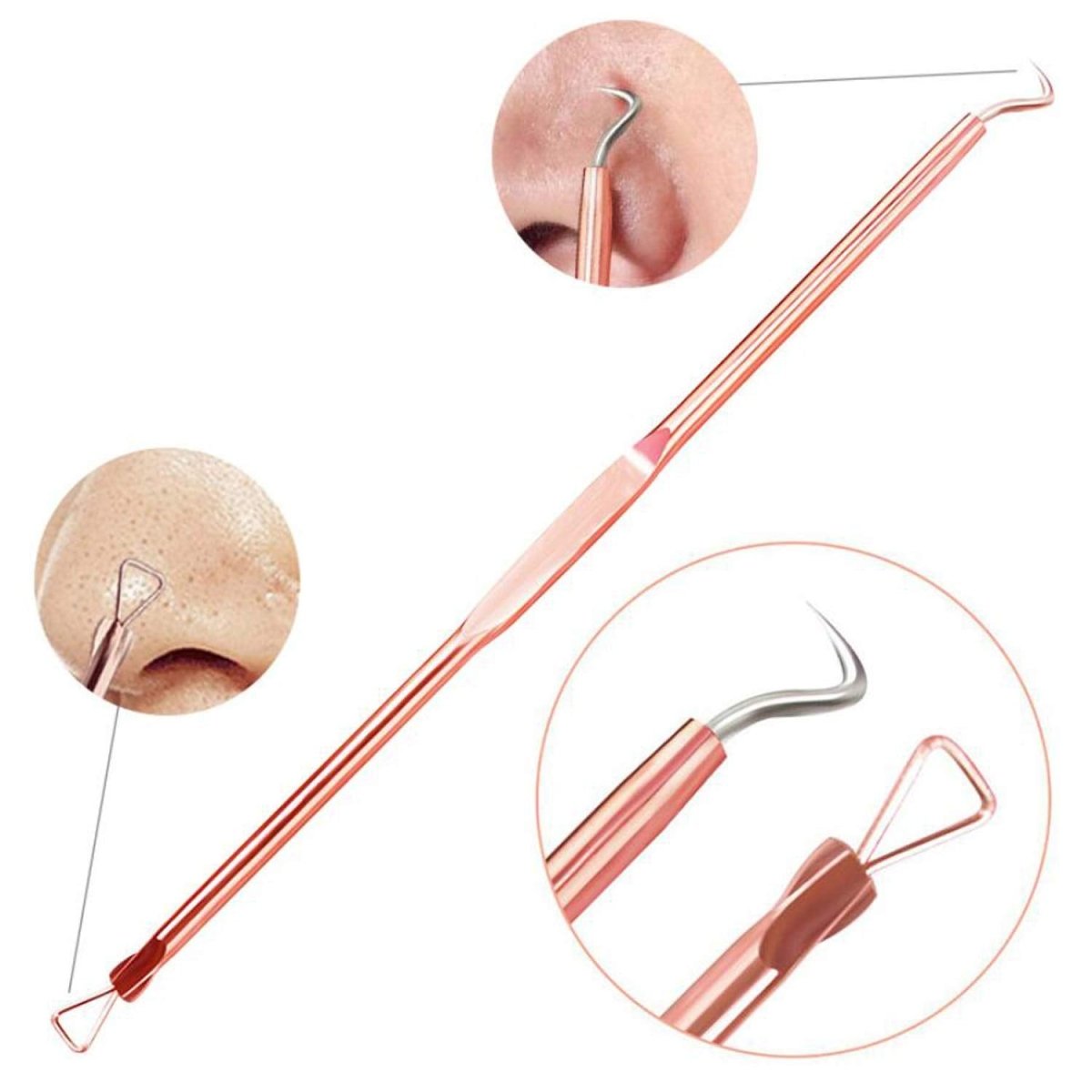 Blackhead & Pimple Removal Kit – Comedone Extractor Tool Set, Blackhead Remover Tools with Travel Case - Nalani - Fashion Clothing and Decor