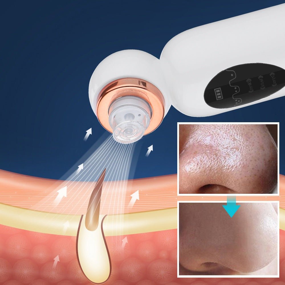 Blackhead Remover and Hydrodermabrasion – Pore Vacuum & Hydro Facial Device for Home, Water & Oxygen Cleansing – HydraGlow - Nalani - Fashion Clothing and Decor